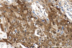 PTPN9 Rabbit Polyclonal Antibody, Proteintech:Antibodies:Primary Antibodies