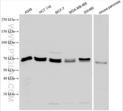 PTPN9 Rabbit Polyclonal Antibody, Proteintech:Antibodies:Primary Antibodies
