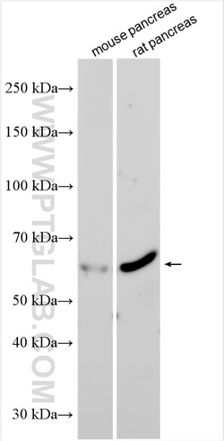 PTPN9 Rabbit Polyclonal Antibody, Proteintech:Antibodies:Primary Antibodies