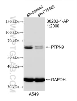 PTPN9 Rabbit Polyclonal Antibody, Proteintech:Antibodies:Primary Antibodies