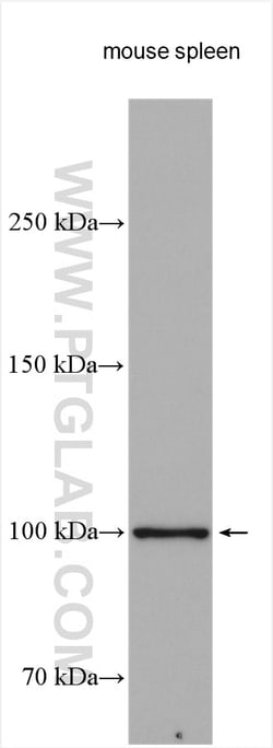 PTPRK Rabbit Polyclonal Antibody, Proteintech Unconjugated; 20 &mu;L:Antibodies,