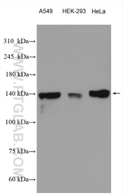 PTPRS Rabbit Polyclonal Antibody, Proteintech Unconjugated; 150 &mu;L:Antibodies,