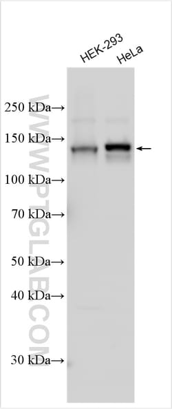 PTPRS Rabbit Polyclonal Antibody, Proteintech Unconjugated; 150 &mu;L:Antibodies,