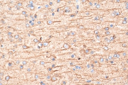 PTPRT Rabbit Polyclonal Antibody, Proteintech Unconjugated; 150 &mu;L:Antibodies,