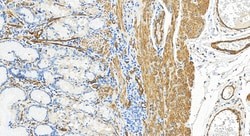 PTRF Rabbit Polyclonal Antibody, Proteintech:Antibodies:Primary Antibodies