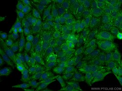 PTRF Rabbit Polyclonal Antibody, Proteintech:Antibodies:Primary Antibodies