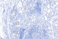 Pericentrin Rabbit Polyclonal Antibody, Proteintech Unconjugated; 150 &mu;L:Anticorps,