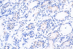 Pericentrin Rabbit Polyclonal Antibody, Proteintech Unconjugated; 150 &mu;L:Anticorps,