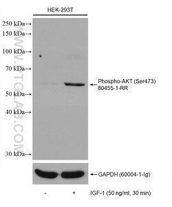 Phospho-AKT (Ser473) Rabbit Recombinant Antibody, Proteintech Unconjugated;