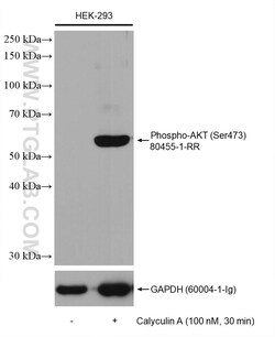 Phospho-AKT (Ser473) Rabbit Recombinant Antibody, Proteintech Unconjugated;