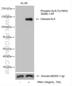 Phospho-ALK (Tyr1604) Rabbit Polyclonal Antibody, Proteintech 100 &mu;L | Buy Online | Proteintech | Fisher Scientific