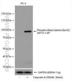 Phospho-Beta Catenin (Ser33) Rabbit Polyclonal Antibody, Proteintech Unconjugated;