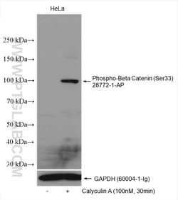 Phospho-Beta Catenin (Ser33) Rabbit Polyclonal Antibody, Proteintech Unconjugated;