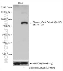 Phospho-Beta Catenin (Ser37) Rabbit Polyclonal Antibody, Proteintech Unconjugated;