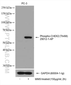 Phospho-CHEK2 (Thr68) Rabbit Polyclonal Antibody, Proteintech:Antibodies:Primary