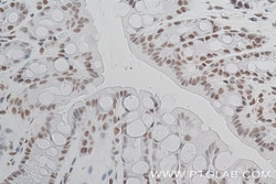 Phospho-CREB1 (Ser133) Rabbit Recombinant Antibody, Proteintech:Antibodies:Primary