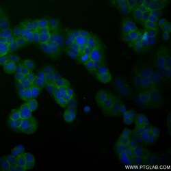 Phospho-Beta Catenin (Ser675) Rabbit Recombinant Antibody, Proteintech:Antibodies:Primary