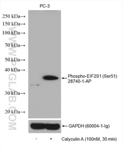 Phospho-EIF2S1 (Ser51) Rabbit Polyclonal Antibody, Proteintech
