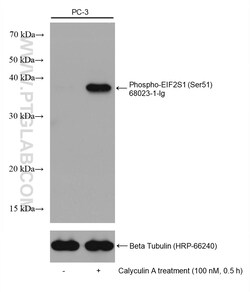 Phospho-EIF2S1 (Ser51) Mouse Monoclonal Antibody, Proteintech:Antibodies:Primary