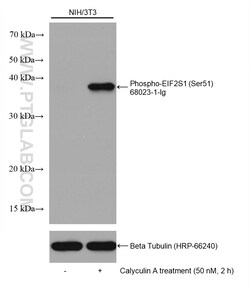 Phospho-EIF2S1 (Ser51) Mouse Monoclonal Antibody, Proteintech:Antibodies:Primary