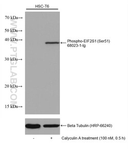 Phospho-EIF2S1 (Ser51) Mouse Monoclonal Antibody, Proteintech:Antibodies:Primary