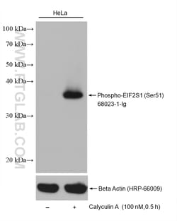 Phospho-EIF2S1 (Ser51) Mouse Monoclonal Antibody, Proteintech:Antibodies:Primary