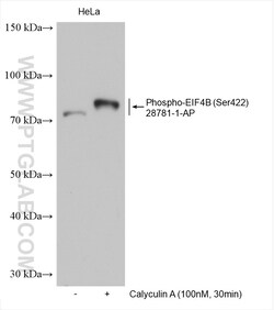 Phospho-EIF4B (Ser422) Rabbit Polyclonal Antibody, Proteintech Unconjugated;