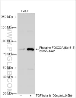 Phospho-FOXO3A (Ser315) Rabbit Polyclonal Antibody, Proteintech:Antibodies:Primary