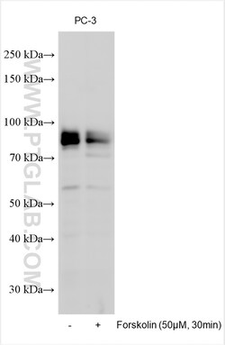 Phospho-FOXO3A (Ser315) Rabbit Polyclonal Antibody, Proteintech:Antibodies:Primary