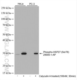 Phospho-HSP27 (Ser78) Rabbit Polyclonal Antibody, Proteintech:Antibodies:Primary