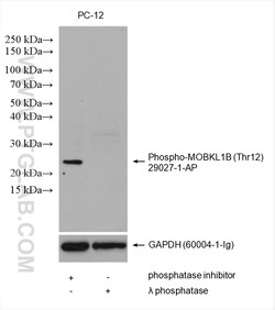 Phospho-MOBKL1B (Thr12) Rabbit Polyclonal Antibody, Proteintech:Antibodies:Primary