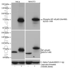 Phospho-NF- B p65 (Ser468) Rabbit Recombinant Antibody, Proteintech Unconjugated;