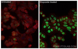 Phospho-P53 (Ser15) Rabbit Polyclonal Antibody, Proteintech Unconjugated;