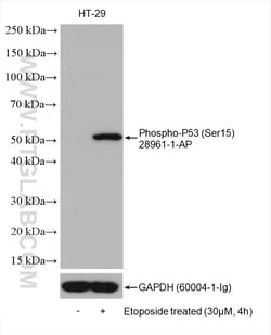 Phospho-P53 (Ser15) Rabbit Polyclonal Antibody, Proteintech Unconjugated;