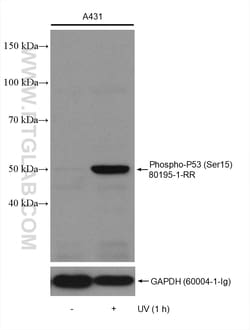 Phospho-P53 (Ser15) Rabbit Recombinant Antibody, Proteintech Unconjugated;