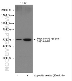 Phospho-P53 (Ser46) Rabbit Polyclonal Antibody, Proteintech:Antibodies:Primary