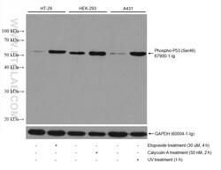 Phospho-P53 (Ser46) Mouse Monoclonal Antibody, Proteintech Unconjugated;