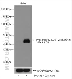 Phospho-P62,SQSTM1 (Ser349) Rabbit Polyclonal Antibody, Proteintech:Antibodies:Primary