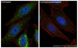 Phospho-PDH E1 Alpha (Ser300) Rabbit Polyclonal Antibody, Proteintech Unconjugated;