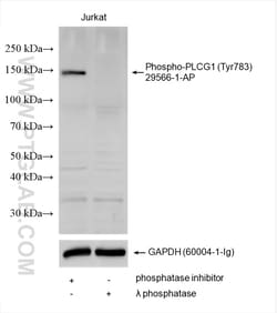 Phospho-PLCG1 (Tyr783) Rabbit Polyclonal Antibody, Proteintech:Antibodies:Primary
