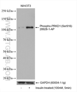 Phospho-PRKD1 (Ser916) Rabbit Polyclonal Antibody, Proteintech:Antibodies:Primary