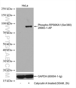 Phospho-RPS6KA1 (Ser380) Rabbit Polyclonal Antibody, Proteintech Unconjugated;