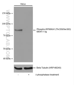 Phospho-RPS6KA1 (Thr359/Ser363) Mouse Monoclonal Antibody, Proteintech