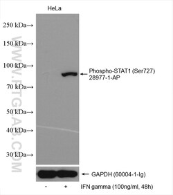 Phospho-STAT1 (Ser727) Rabbit Polyclonal Antibody, Proteintech:Antibodies:Primary