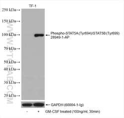 Phospho-STAT5A (Tyr694)/STAT5B (Tyr699) Rabbit Polyclonal Antibody, Proteintech:Antibodies:Primary