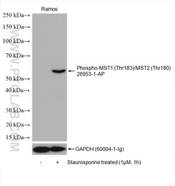 Phospho-MST1 (Thr183)/MST2 (Thr180) Rabbit Polyclonal Antibody, Proteintech:Antibodies:Primary