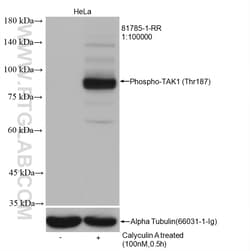 Phospho-TAK1 (Thr187) Rabbit Recombinant Antibody, Proteintech Unconjugated;