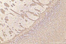Phospho-TAU (Thr181) Rabbit Polyclonal Antibody, Proteintech Unconjugated;