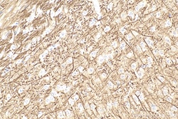 Phospho-TAU (Thr181) Rabbit Polyclonal Antibody, Proteintech Unconjugated;