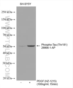 Phospho-TAU (Thr181) Rabbit Polyclonal Antibody, Proteintech Unconjugated;